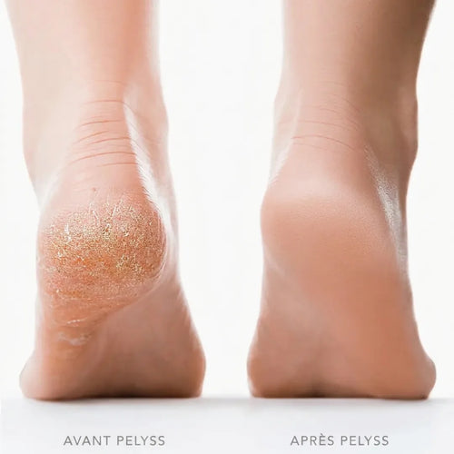Pelyss Pure™