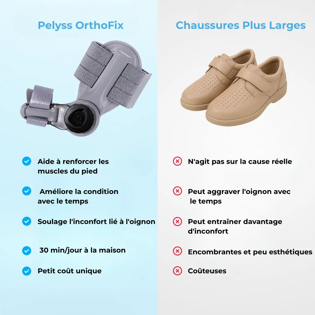 Pelyss™ OrthoFix — Correcteur d'Hallux Valgus Articulé