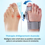 Pelyss™ OrthoFix — Correcteur d'Hallux Valgus Articulé