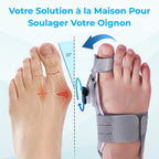Pelyss™ OrthoFix — Correcteur d'Hallux Valgus Articulé