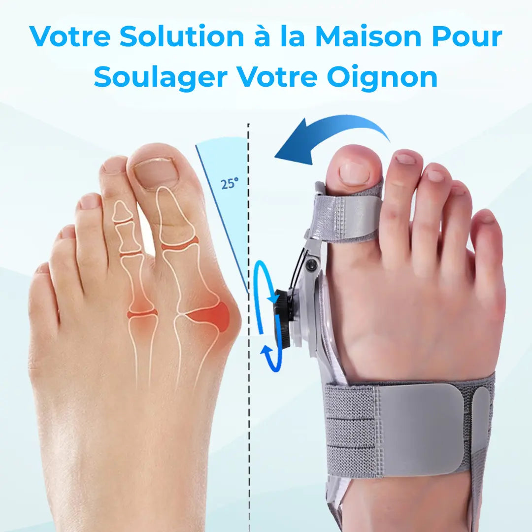 Pelyss™ OrthoFix — Correcteur d'Hallux Valgus Articulé